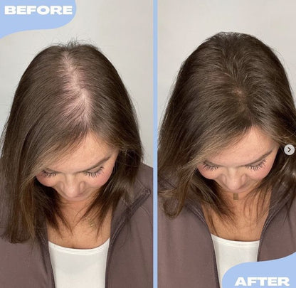 FEG Plus Hair Growth Spray (Original)